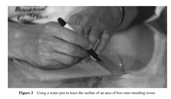 Using a water pen to trace area of loss onto tissue